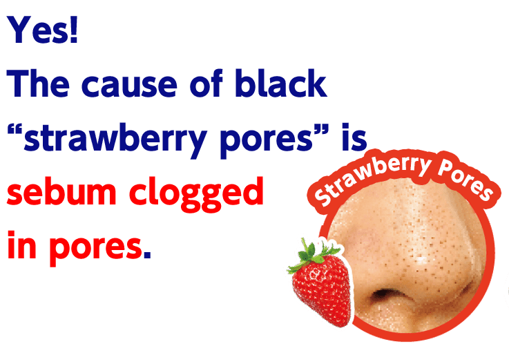 Yes! The cause of black “strawberry pores” is sebum clogged in pores.